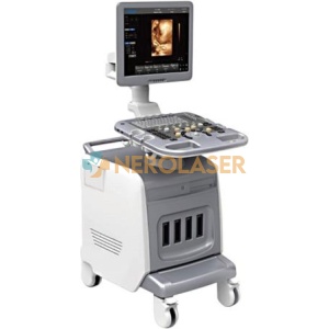 CHISON i3 Ultrasound Scanner