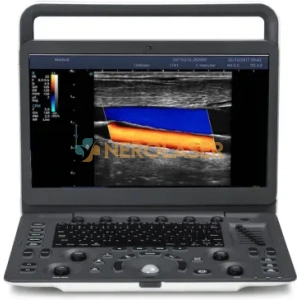 Sonoscape Ultrasound E2 Machine